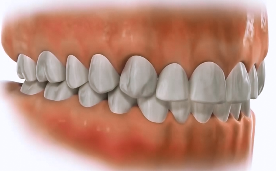 normal occlusion frontal